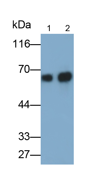 Polyclonal Antibody to Albumin (ALB)