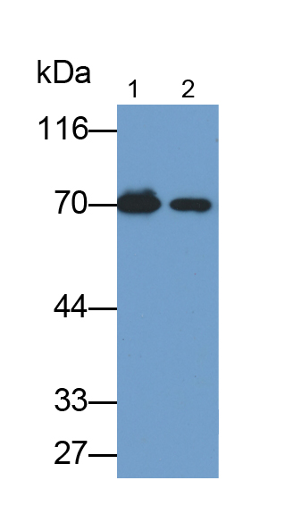 Polyclonal Antibody to Albumin (ALB)