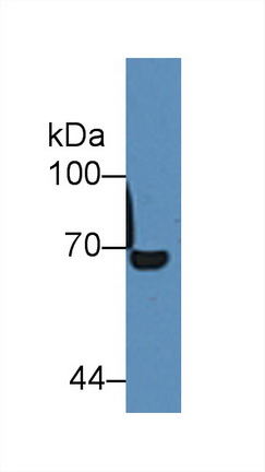 Polyclonal Antibody to Albumin (ALB)