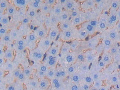 Polyclonal Antibody to Albumin (ALB)