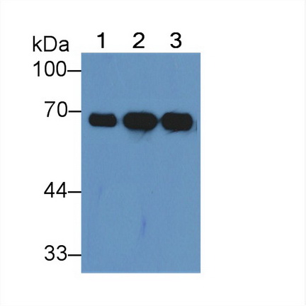 Polyclonal Antibody to Albumin (ALB)