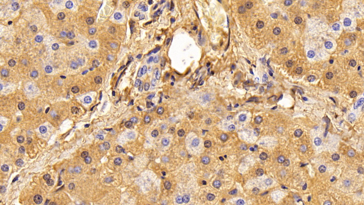 Polyclonal Antibody to Albumin (ALB)