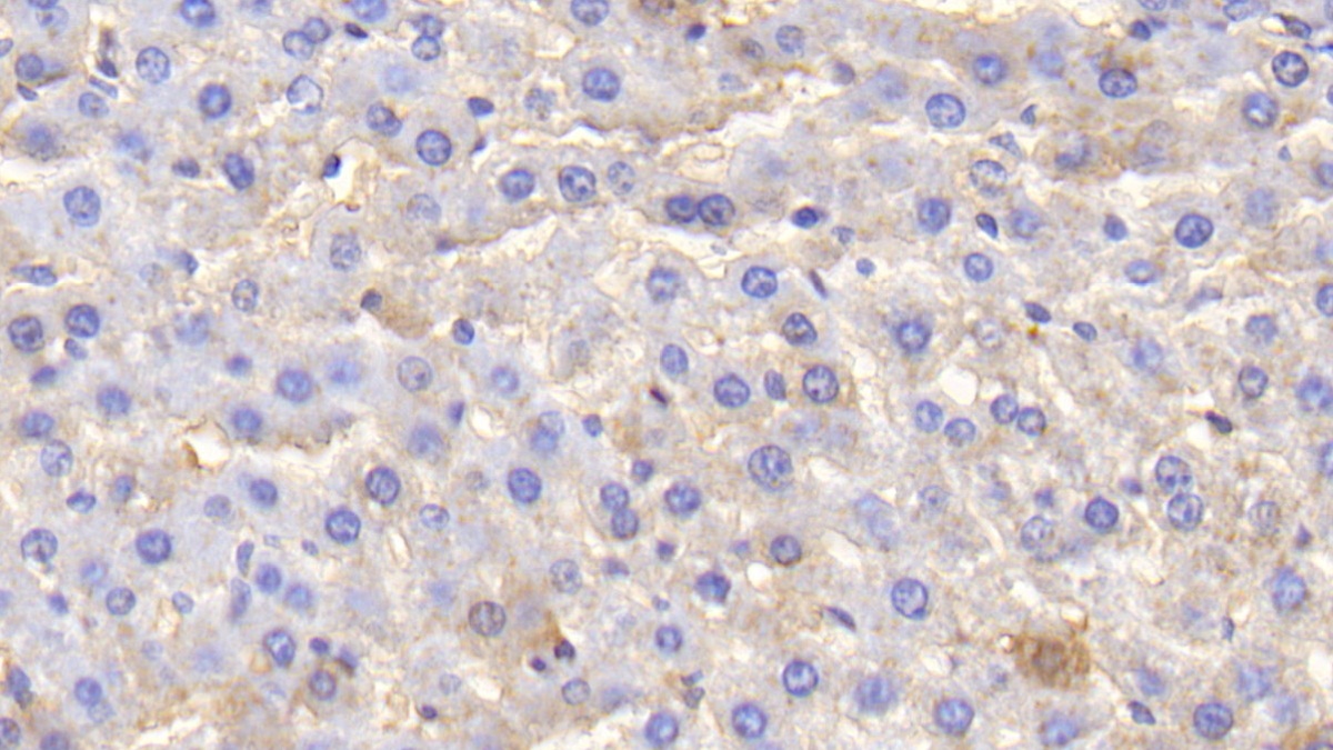 Polyclonal Antibody to Albumin (ALB)