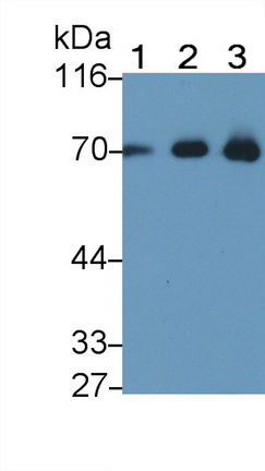 Polyclonal Antibody to Albumin (ALB)