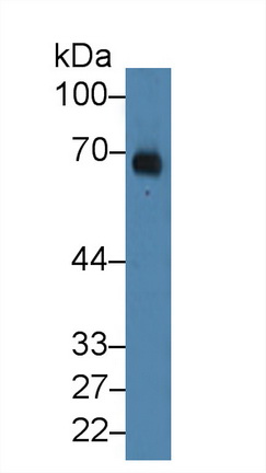 Polyclonal Antibody to Albumin (ALB)