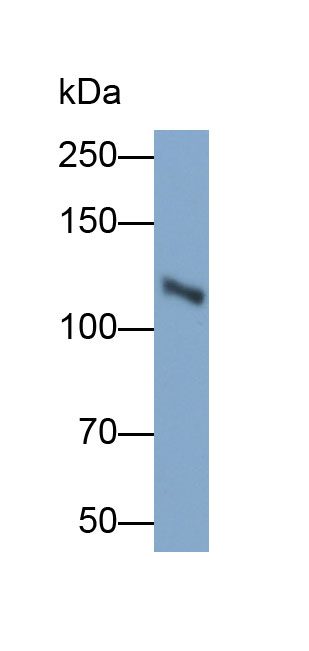 Polyclonal Antibody to Integrin Alpha 2B (ITGa2B)