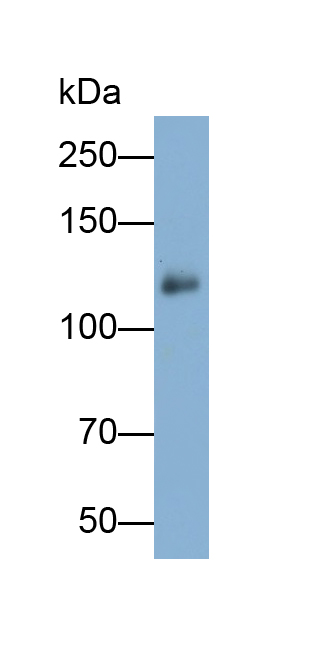 Polyclonal Antibody to Integrin Alpha 2B (ITGa2B)