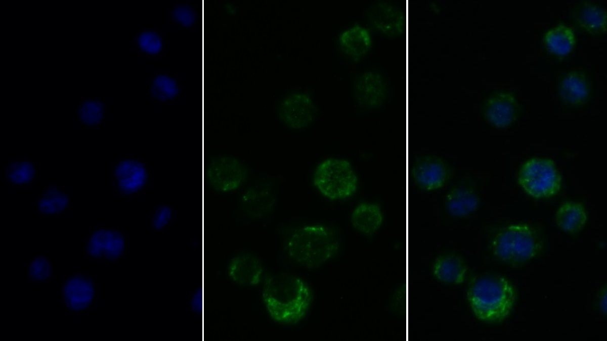 Polyclonal Antibody to Protein Tyrosine Phosphatase Receptor Type C (CD45)