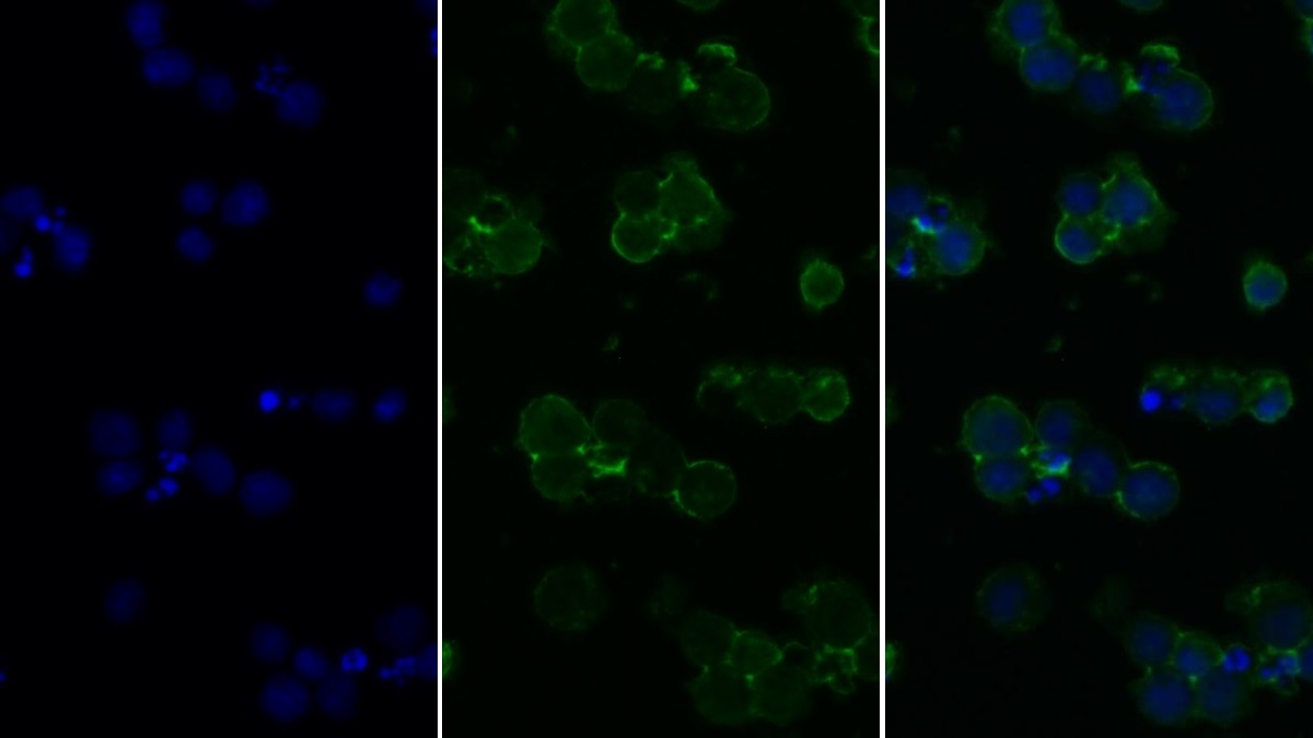 Polyclonal Antibody to Protein Tyrosine Phosphatase Receptor Type C (CD45)