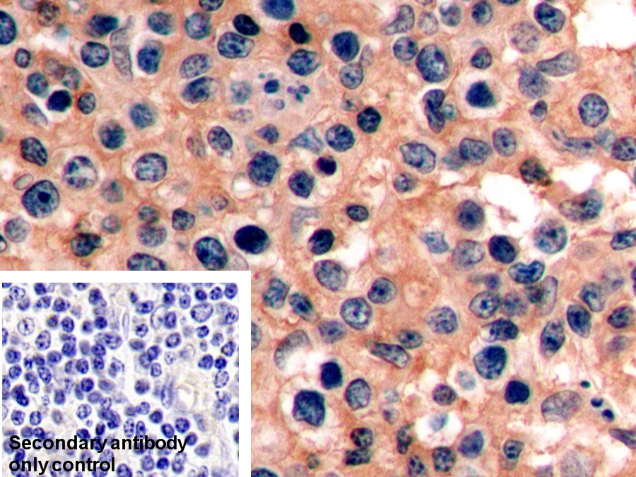 Polyclonal Antibody to Protein Tyrosine Phosphatase Receptor Type C (CD45)