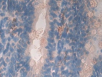 Polyclonal Antibody to Growth Hormone Receptor (GHR)