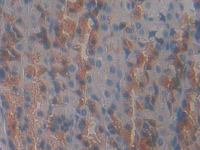 Polyclonal Antibody to Growth Hormone Receptor (GHR)