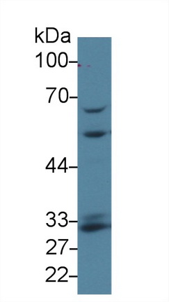 Polyclonal Antibody to Glutamate Cysteine Ligase, Modifier Subunit (GCLM)