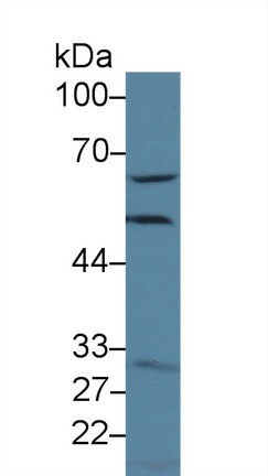 Polyclonal Antibody to Glutamate Cysteine Ligase, Modifier Subunit (GCLM)