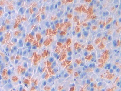 Polyclonal Antibody to Surfactant Associated Protein D (SPD)