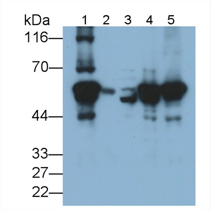 Polyclonal Antibody to Vimentin (VIM)