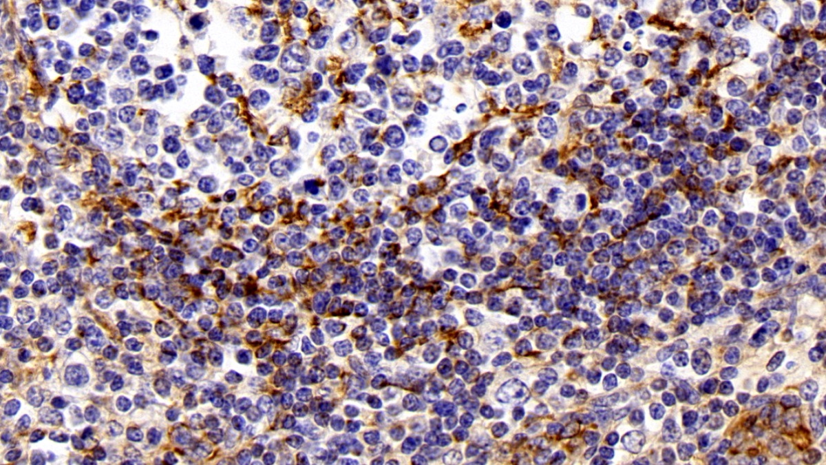 Polyclonal Antibody to Vimentin (VIM)