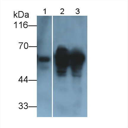 Polyclonal Antibody to Vimentin (VIM)