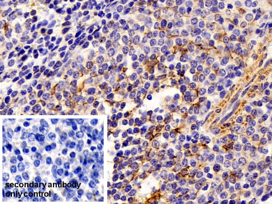 Polyclonal Antibody to Vimentin (VIM)