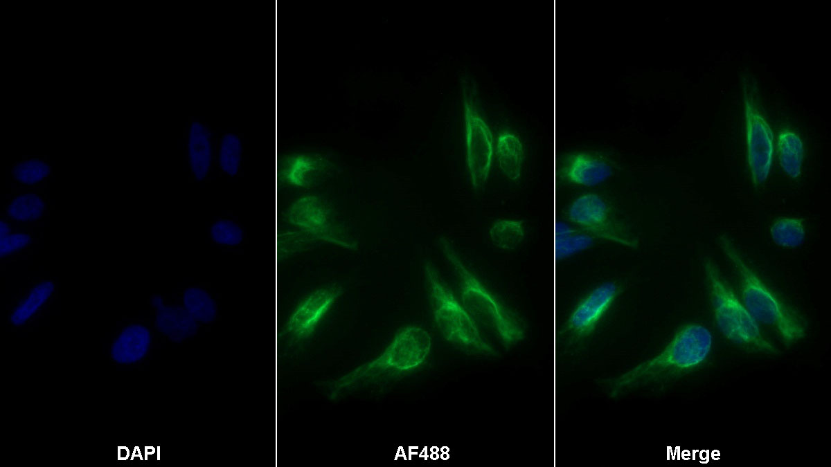 Polyclonal Antibody to Vimentin (VIM)