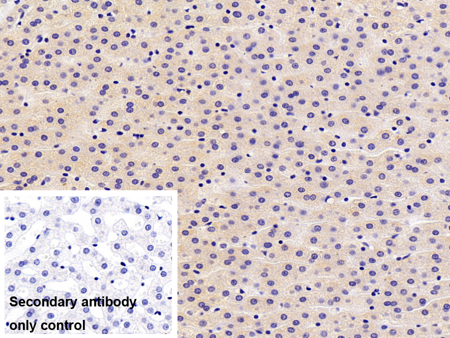 Polyclonal Antibody to Vitronectin (VTN)