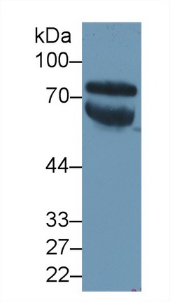 Polyclonal Antibody to Vitronectin (VTN)