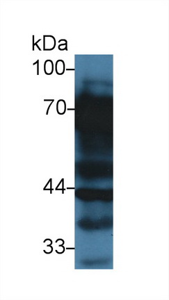 Polyclonal Antibody to Vitronectin (VTN)