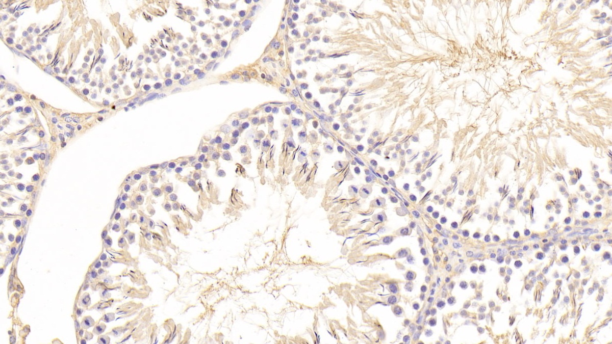 Polyclonal Antibody to Vitronectin (VTN)