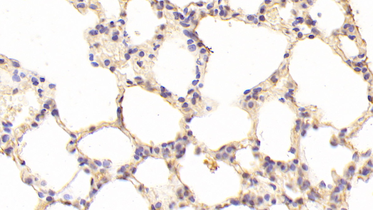 Polyclonal Antibody to Vitronectin (VTN)