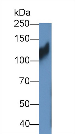 Polyclonal Antibody to Integrin Beta 1 (ITGb1)