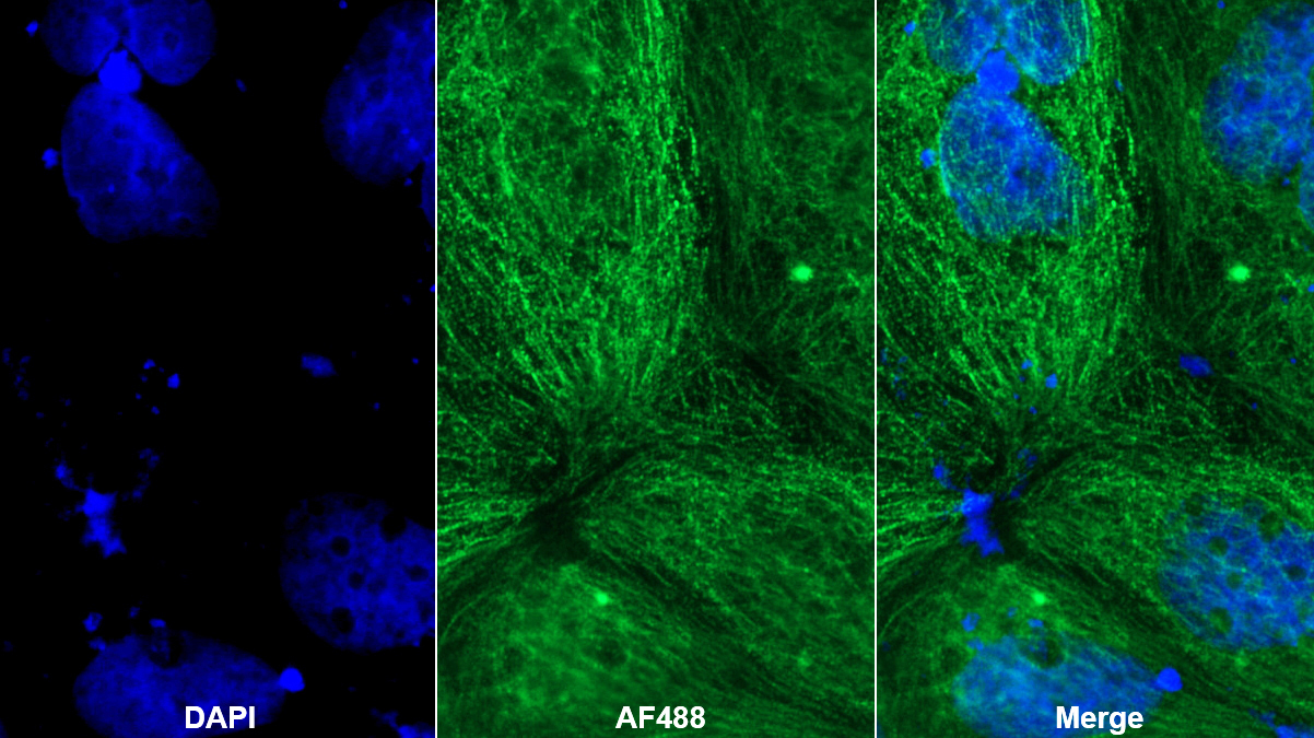 Polyclonal Antibody to Cholecystokinin 8 (CCK8)