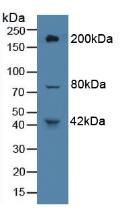 Polyclonal Antibody to Protein Tyrosine Phosphatase Receptor Type B (PTPRB)