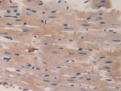 Polyclonal Antibody to Protein Tyrosine Phosphatase Receptor Type B (PTPRB)