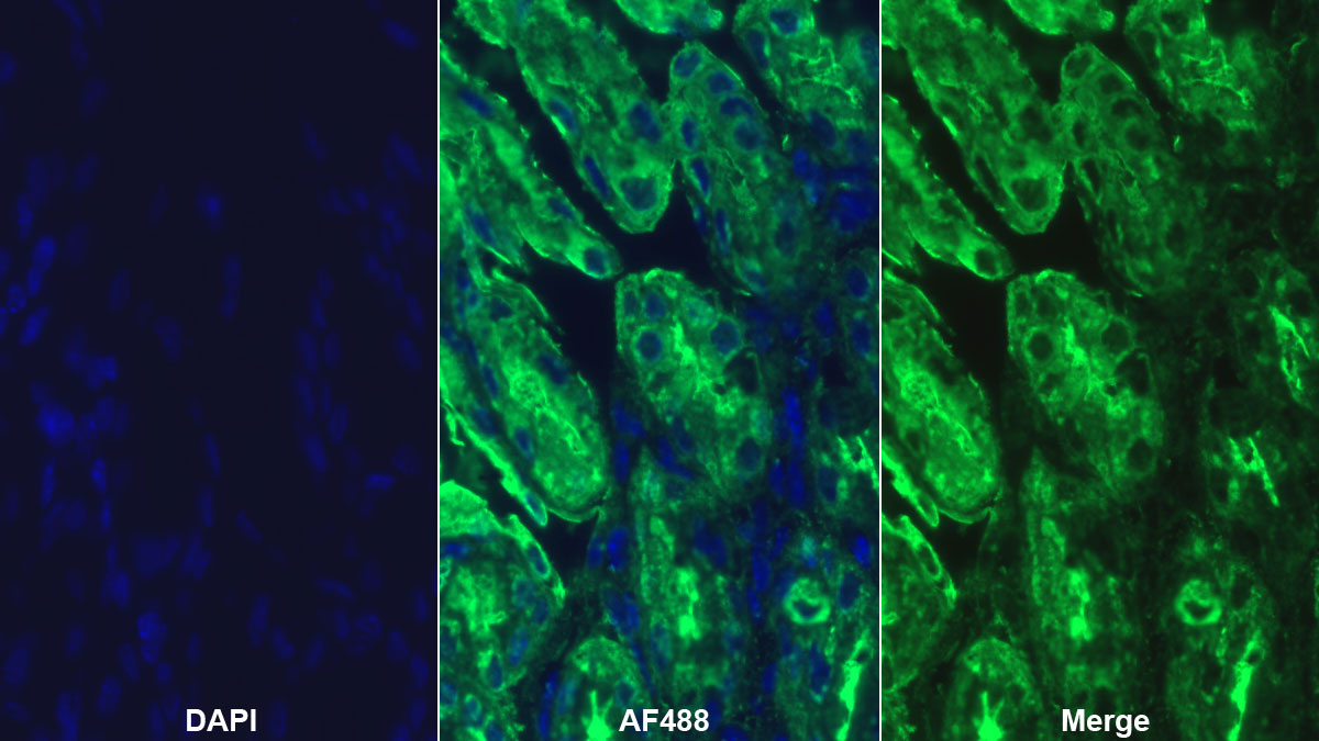 Polyclonal Antibody to Trefoil Factor 1 (TFF1)