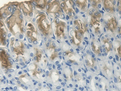 Polyclonal Antibody to Trefoil Factor 1 (TFF1)