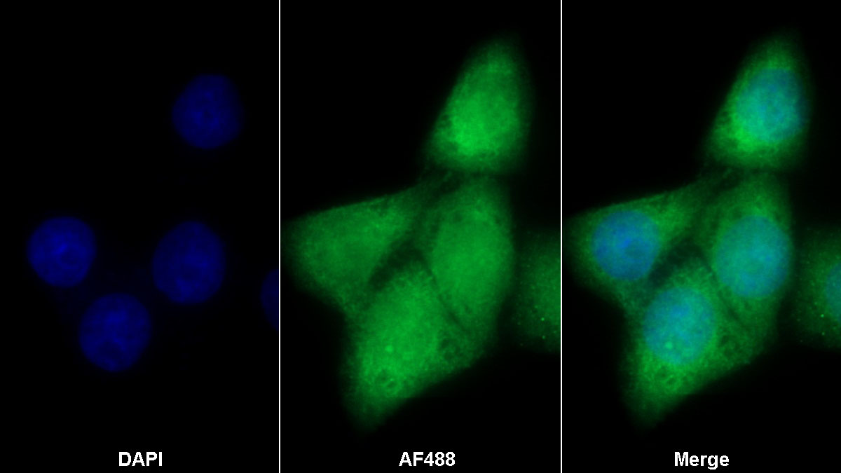 Polyclonal Antibody to Estrogen Receptor Alpha (ERa)