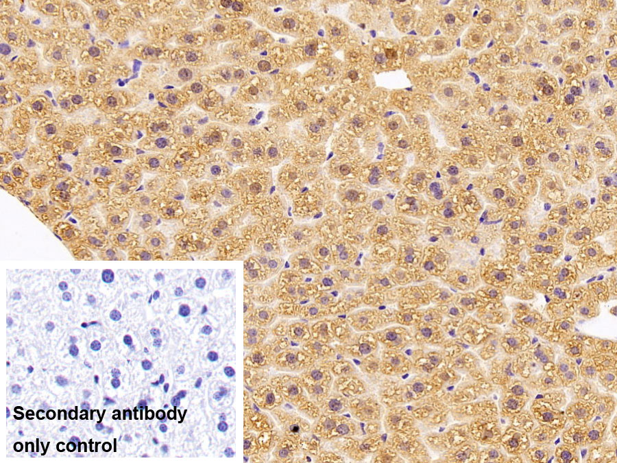 Polyclonal Antibody to Cytochrome P450 7A1 (CYP7A1)