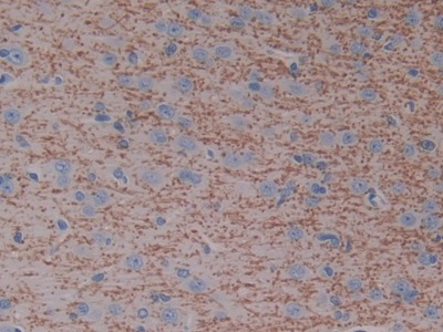 Polyclonal Antibody to Cytochrome P450 7A1 (CYP7A1)