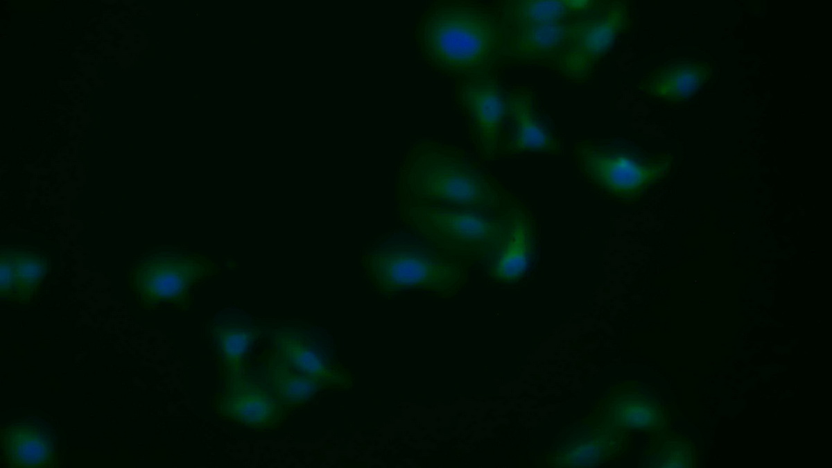 Polyclonal Antibody to Apoptotic Peptidase Activating Factor 1 (APAF1)