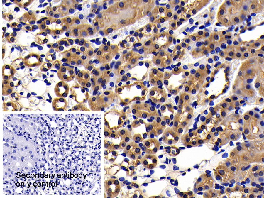 Polyclonal Antibody to Apoptotic Peptidase Activating Factor 1 (APAF1)