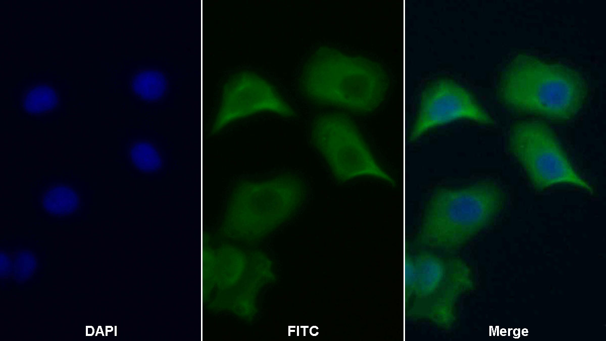 Polyclonal Antibody to Apoptotic Peptidase Activating Factor 1 (APAF1)