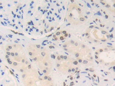 Polyclonal Antibody to High Mobility Group Nucleosome Binding Domain Containing Protein 2 (HMGN2)