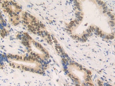 Polyclonal Antibody to High Mobility Group Nucleosome Binding Domain Containing Protein 2 (HMGN2)