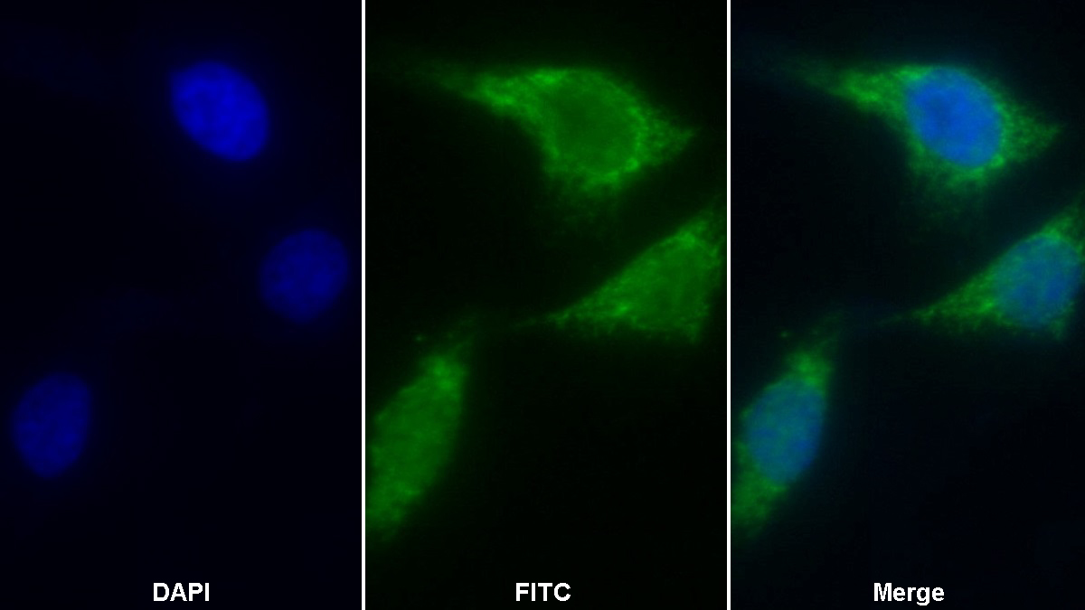 Polyclonal Antibody to Apoptosis Inducing Factor (AIF)