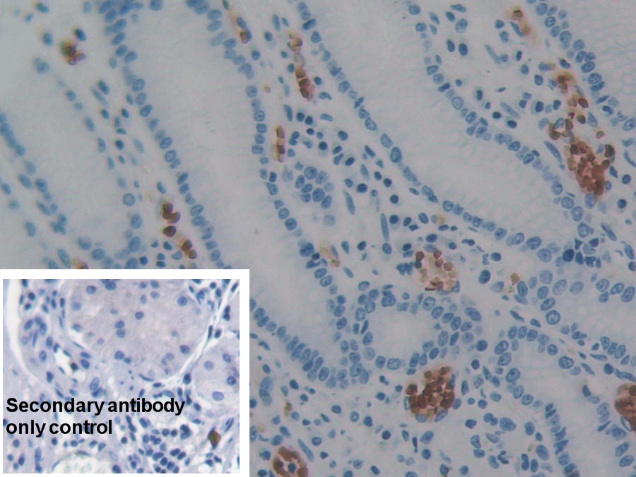 Polyclonal Antibody to Apoptosis Inducing Factor (AIF)