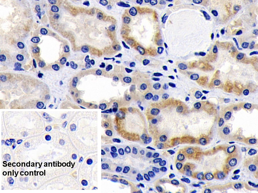 Polyclonal Antibody to Apoptosis Inducing Factor (AIF)