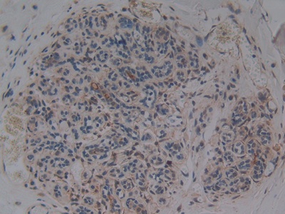 Polyclonal Antibody to Alanine Aminopeptidase (AAP)