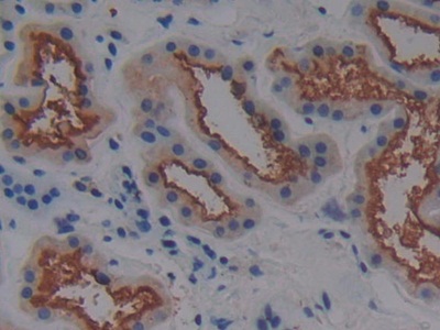 Polyclonal Antibody to Alanine Aminopeptidase (AAP)