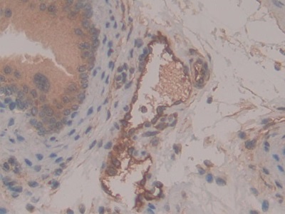 Polyclonal Antibody to Alanine Aminopeptidase (AAP)