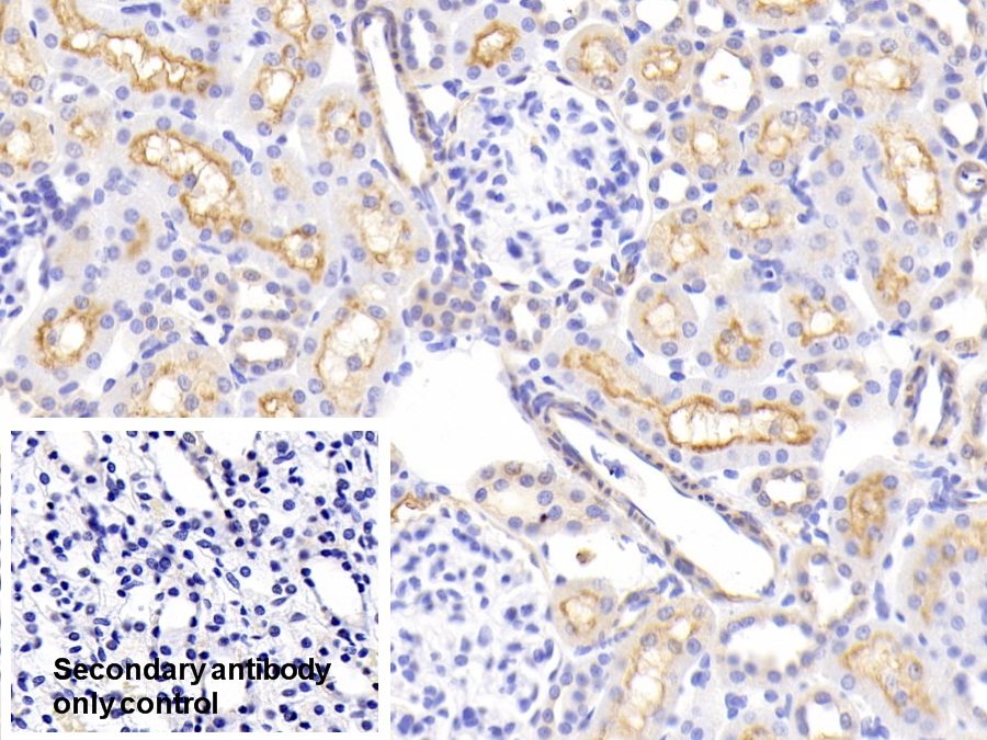 Polyclonal Antibody to Alanine Aminopeptidase (AAP)